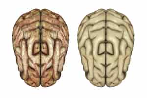 Hemisferio Izquierdo del Cerebro: Características, Habilidades Cognitivas y Creatividad